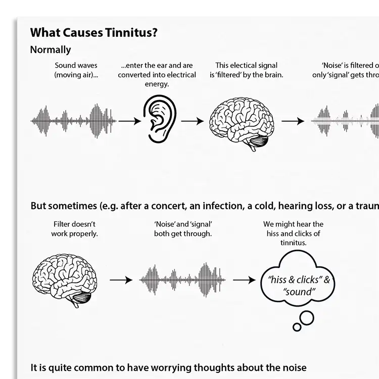 Psychology Tools resource: What Causes Tinnitus?